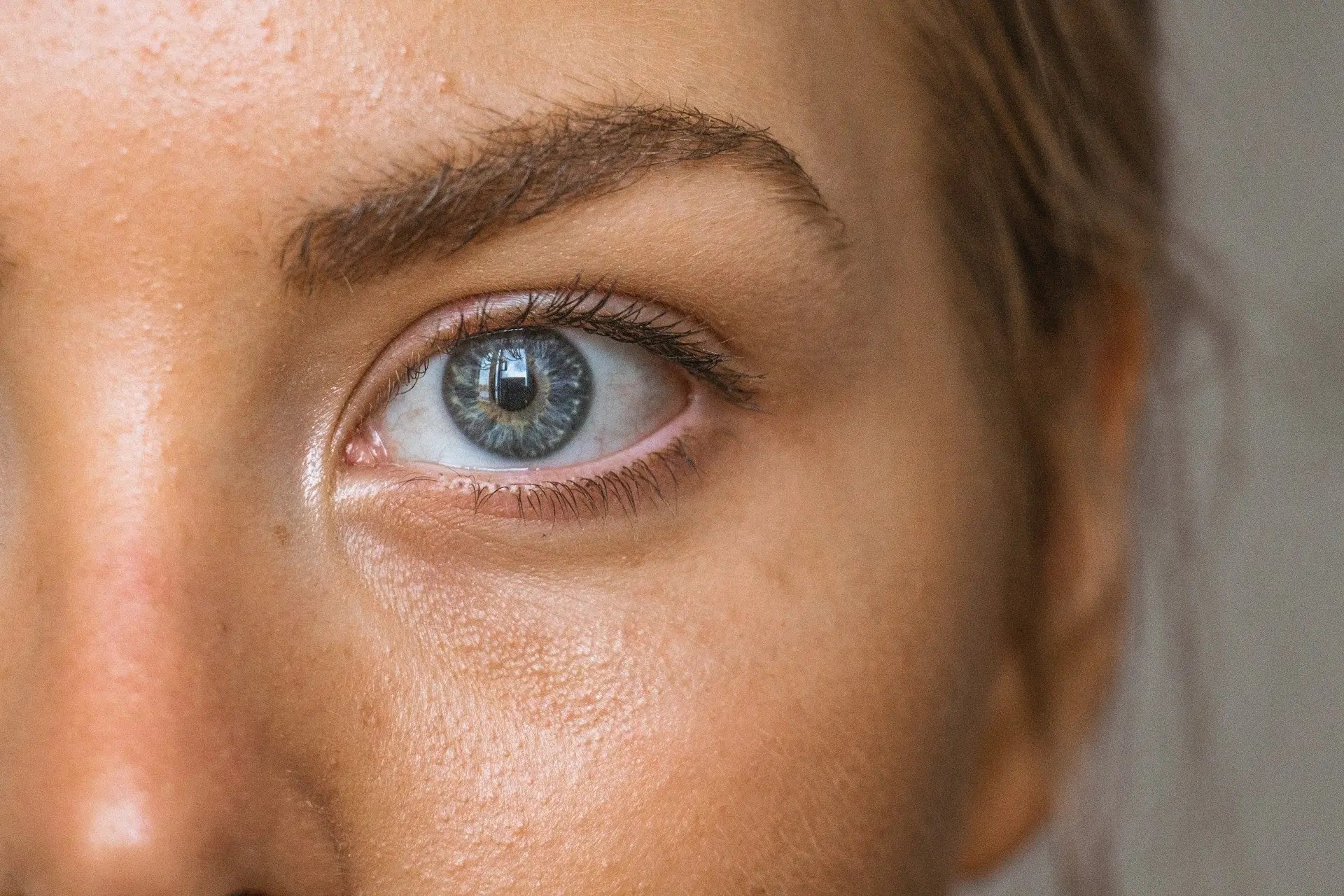 does glutathione cause breakouts pimples Why Glutathione Acne Breakouts? Few Lesser Known Reasons Why