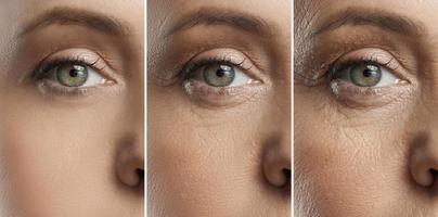 The Best Supplements for Anti-Aging Skin Care