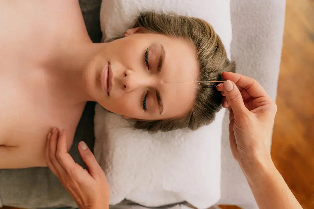 Acupuncture for Menopause: Does It Work? UK Evidence Review