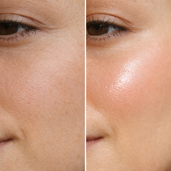 Olivia H. before and after results