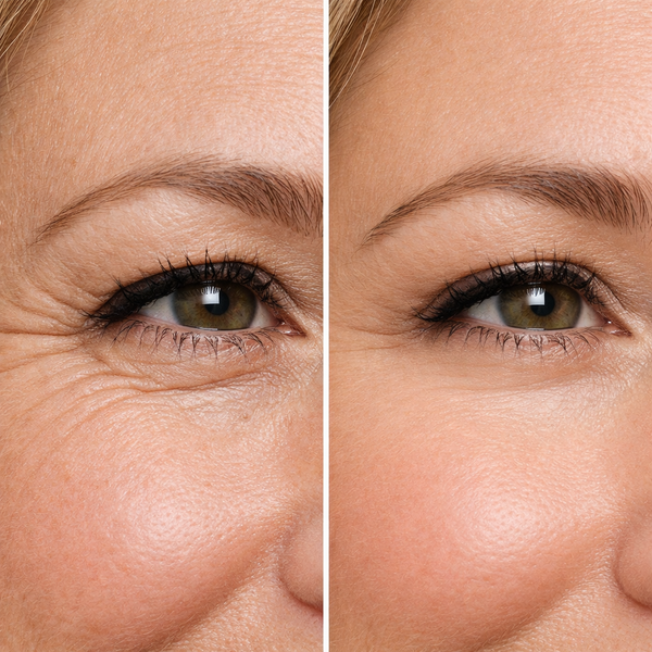 Rachel D. before and after results