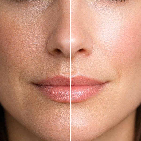 Danielle C. before and after results